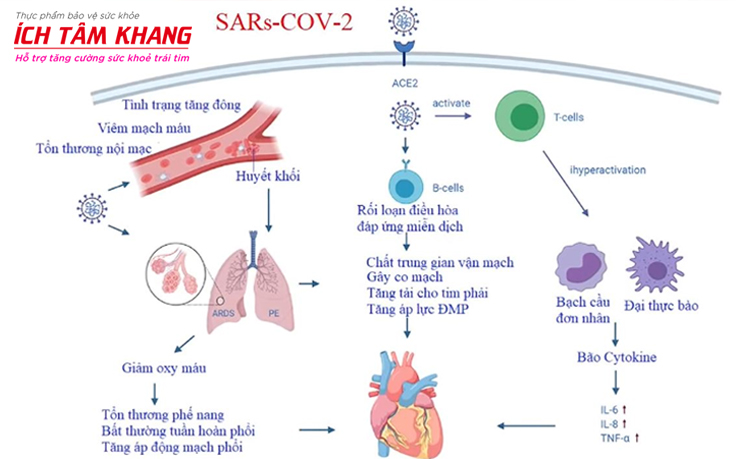 Ảnh hưởng nghiêm trọng của virus SARS- COV- 2 lên hệ tim mạch